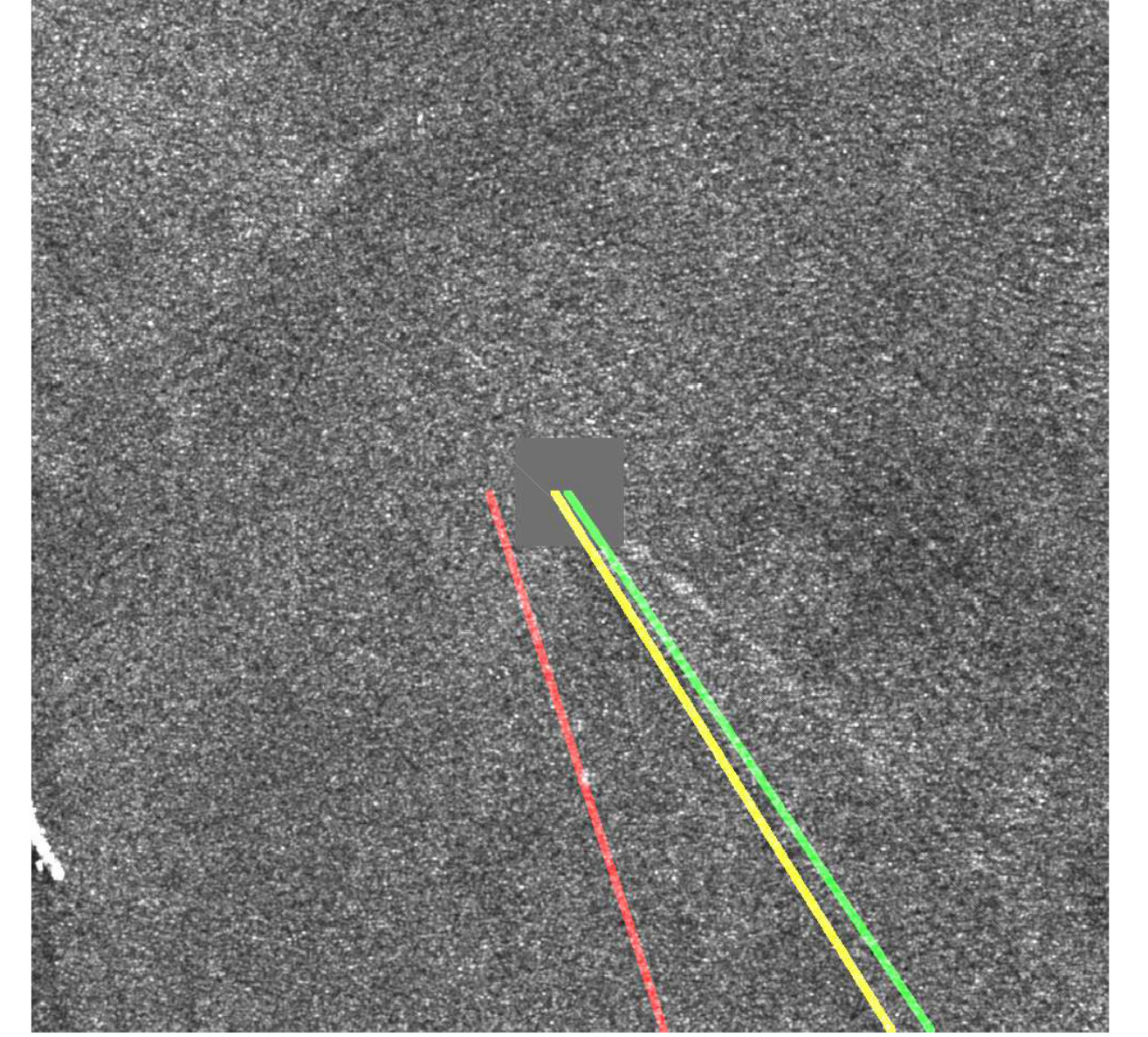 Figure 222